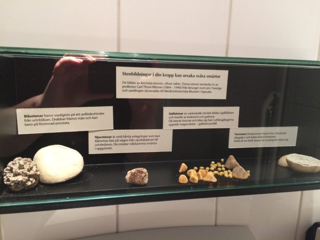 Toiletunderholdningen Ferie i Stockholm